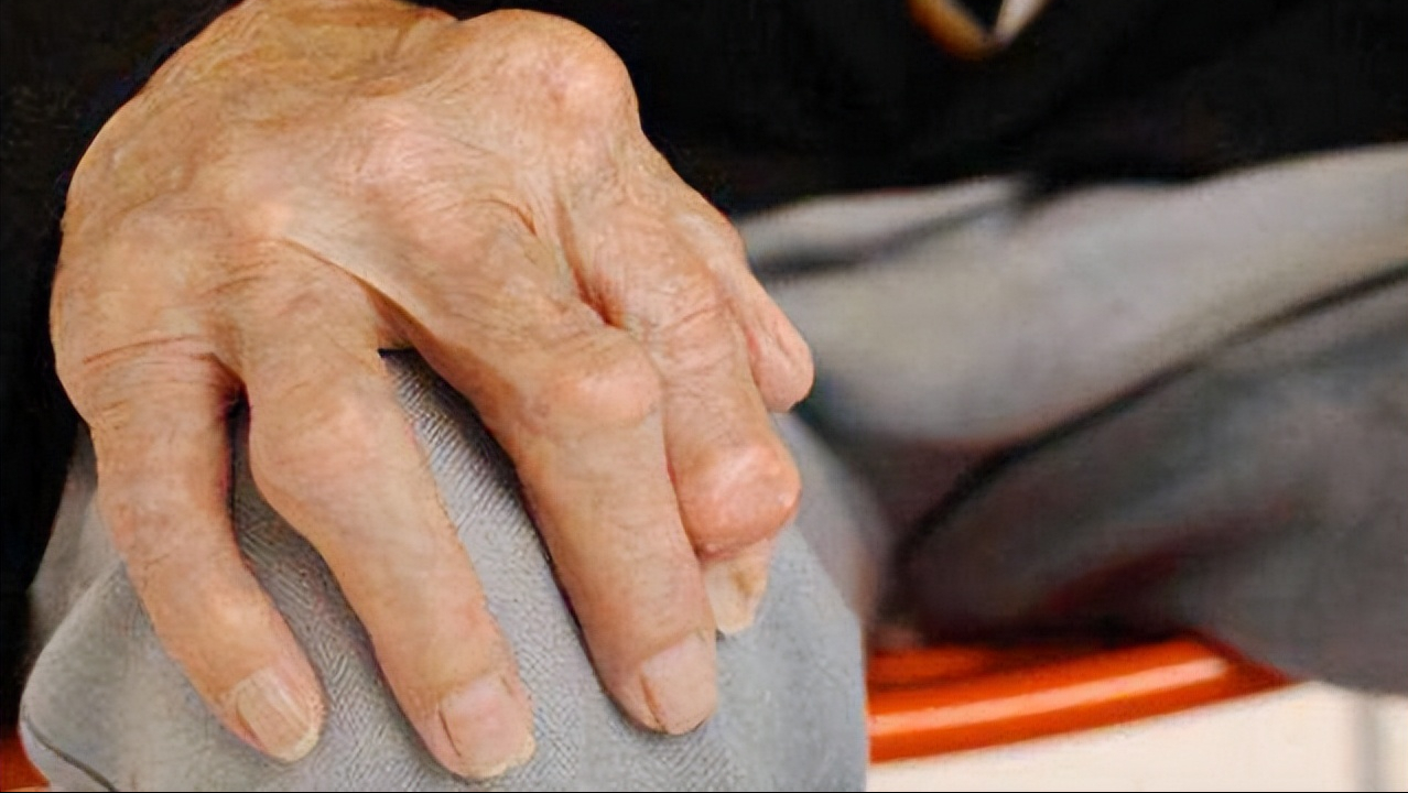 有补钙的针剂吗(补钙针剂有哪些)-硒宝网