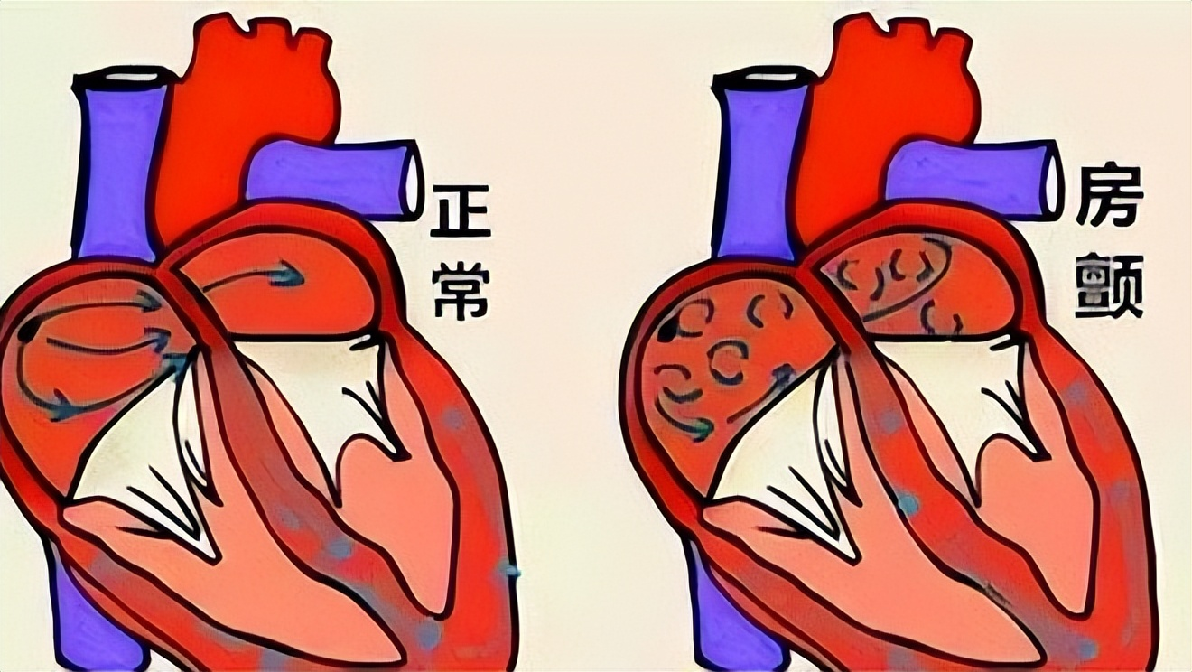 有补钙的针剂吗(补钙针剂有哪些)-硒宝网