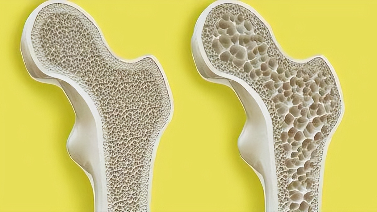 有补钙的针剂吗(补钙针剂有哪些)-硒宝网