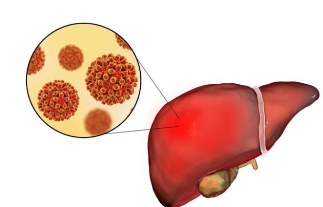 丙肝患者需要补硒吗(丙肝可以补硒吗)-硒宝网