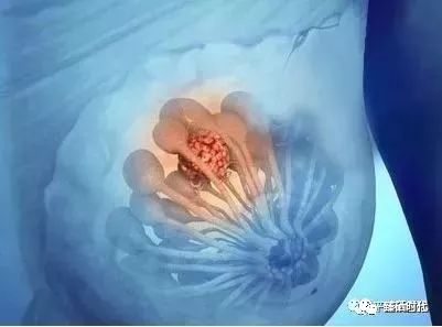 补硒对乳腺结节好吗(乳腺结节补硒能好吗)-硒宝网