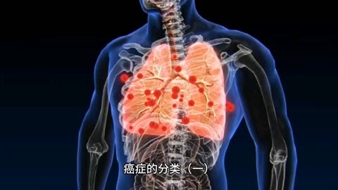 癌症补硒的进口药物（抗癌补硒药）-硒宝网