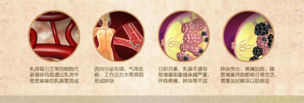 补硒对乳腺结节好吗(乳房有结节补硒管用吗)-硒宝网