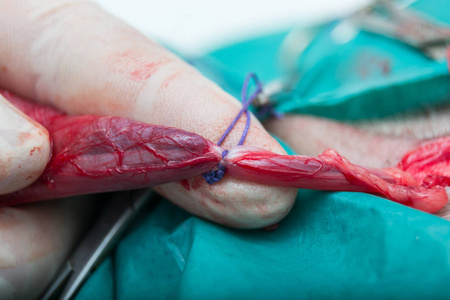 补硒提高精子质量吗（弱精补硒）-硒宝网