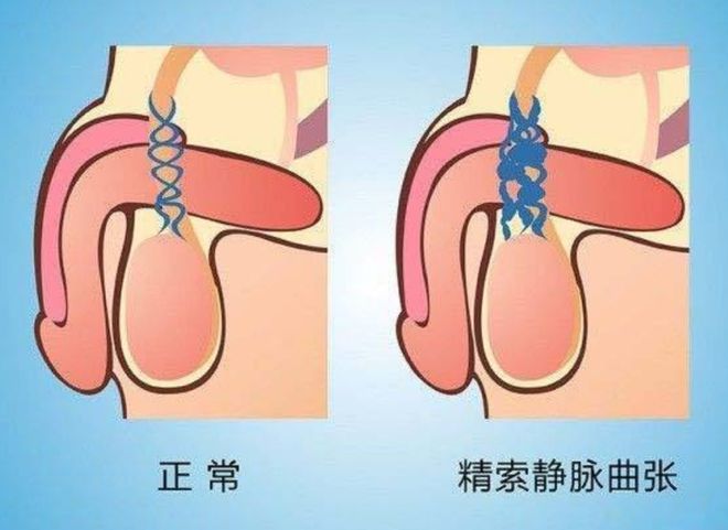 补硒提高精子质量吗（弱精补硒）-硒宝网