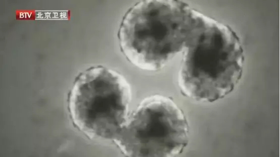 人体每天必须补少硒(每天人体补少硒多少克)-硒宝网