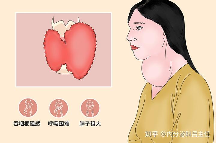 肺部结节补硒能消除（能肺部消除补结节硒元素吗）-硒宝网