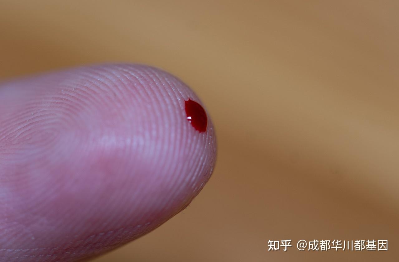 儿童化验微量元素需要空腹吗（儿童微量元素要空腹抽血吗）-硒宝网