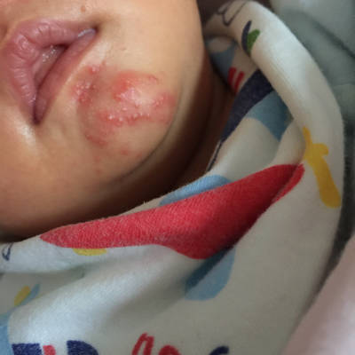 婴儿怎么补锌（婴儿补锌有什么作用和功效）-硒宝网