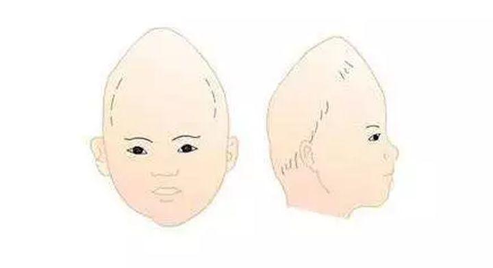 三岁补钙吃什么好(补钙吃好还是输液好)-硒宝网