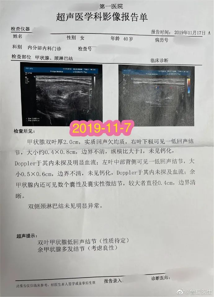 甲状腺侧切补硒好吗(甲状腺全切可以吃硒片吗)-硒宝网