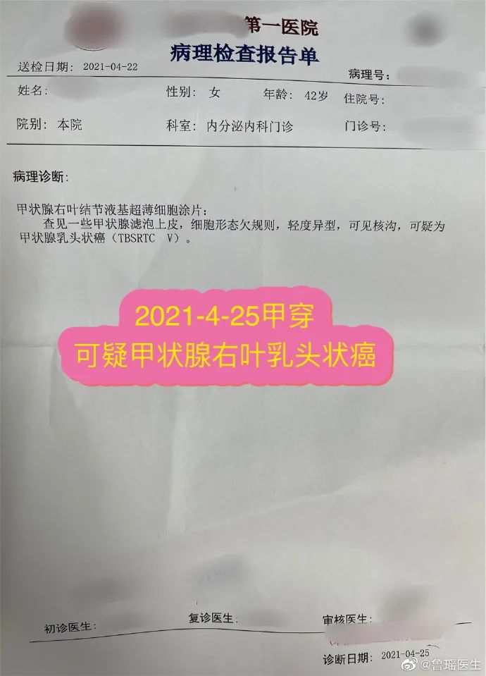 甲状腺侧切补硒好吗(甲状腺全切可以吃硒片吗)-硒宝网