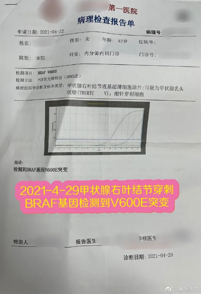 甲状腺侧切补硒好吗(甲状腺全切可以吃硒片吗)-硒宝网