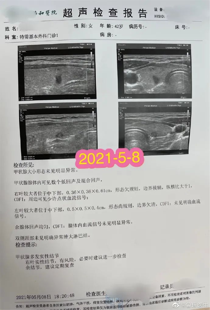 甲状腺侧切补硒好吗(甲状腺全切可以吃硒片吗)-硒宝网