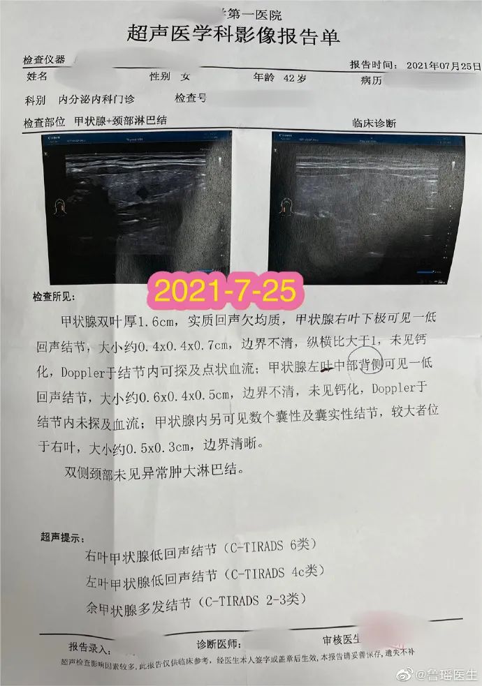 甲状腺侧切补硒好吗(甲状腺全切可以吃硒片吗)-硒宝网