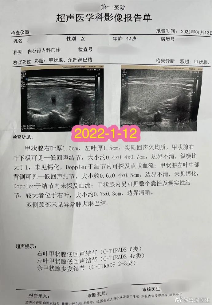 甲状腺侧切补硒好吗(甲状腺全切可以吃硒片吗)-硒宝网