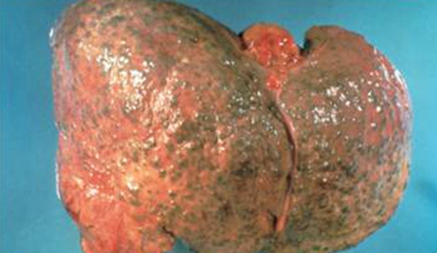 补硒改善睡眠的患者（补硒睡眠好）-硒宝网