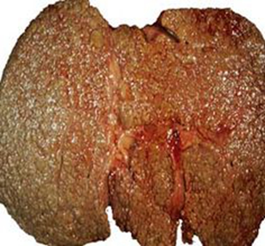 补硒改善睡眠的患者（补硒睡眠好）-硒宝网