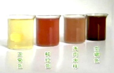 补硒小便什么颜色的（小便补颜色硒片有用吗）-硒宝网