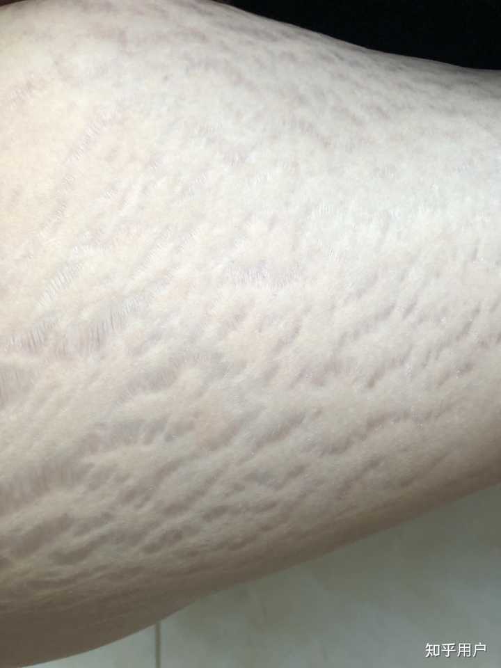 常吃药的人补点儿硒(补硒的药物发胖吗)-硒宝网