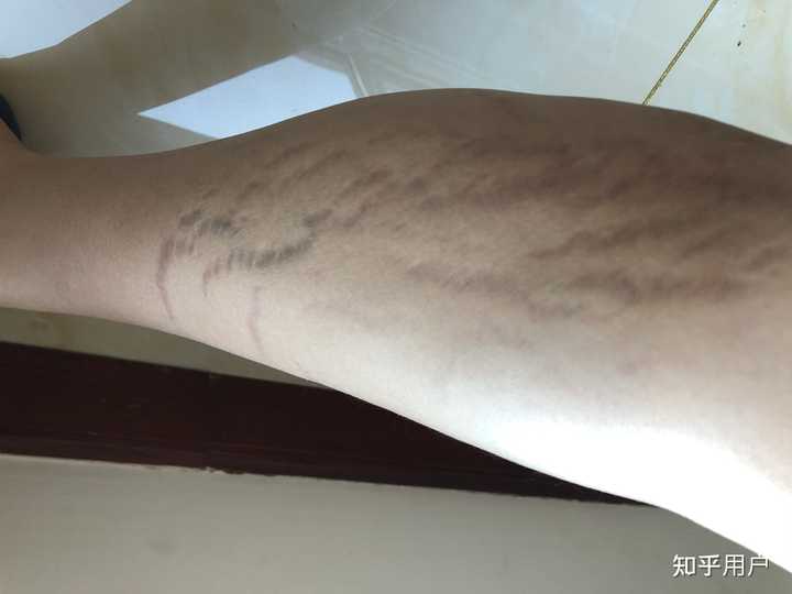 常吃药的人补点儿硒(补硒的药物发胖吗)-硒宝网