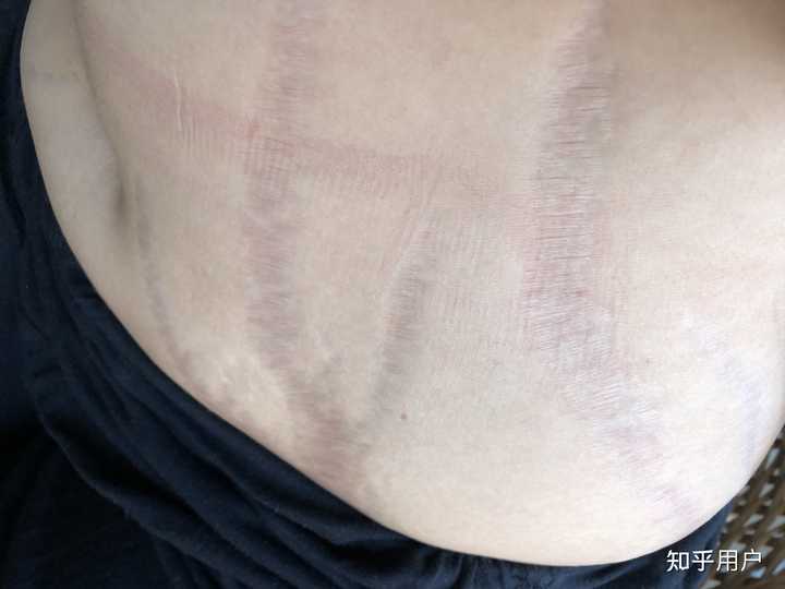 常吃药的人补点儿硒(补硒的药物发胖吗)-硒宝网