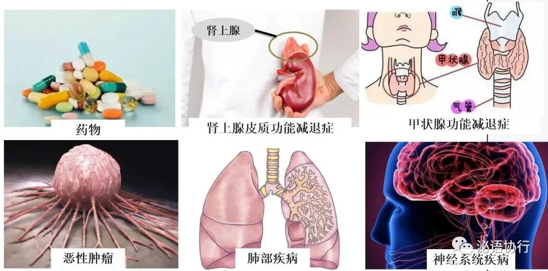 静脉补钠(静脉补钠的浓度)-硒宝网