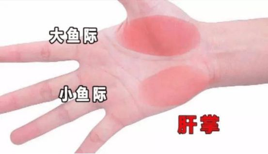 肝硬化是否需要补硒(肝硬化患者缺硒吗)-硒宝网