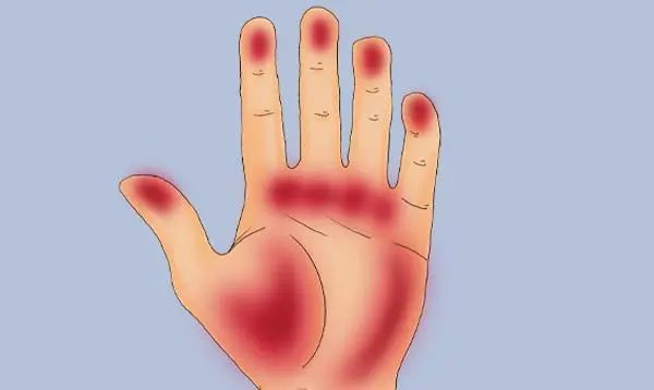 肝硬化是否需要补硒(肝硬化患者缺硒吗)-硒宝网