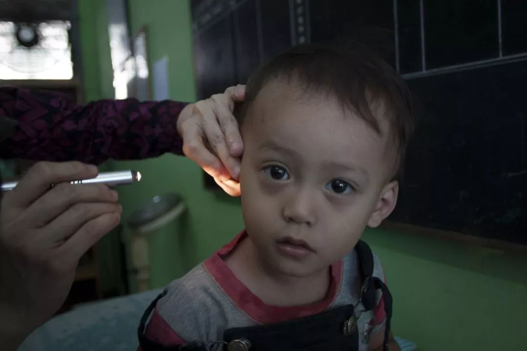 补硒可以抗hpv么(补硒可以治疗hpv阳性吗)-硒宝网