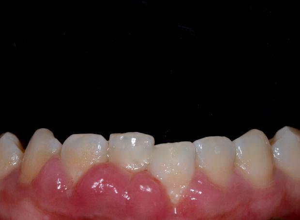 成人需要补钙吗(成人补钙需要吃多久)-硒宝网