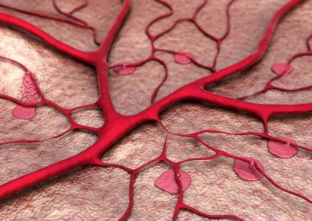 脑梗塞病人如何补硒(补硒对脑梗有哪些作用)-硒宝网