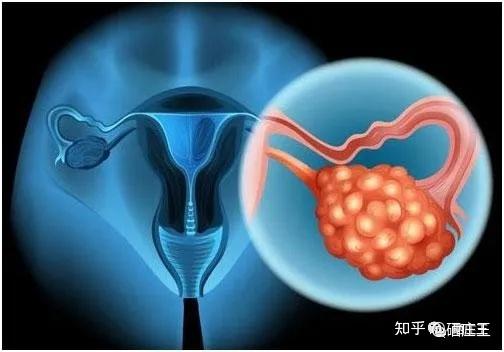 肺癌晚期补硒能好吗(肺癌晚期可以补硒吗)-硒宝网