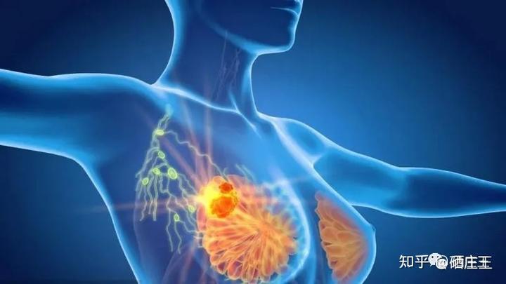 肺癌晚期补硒能好吗(肺癌晚期可以补硒吗)-硒宝网