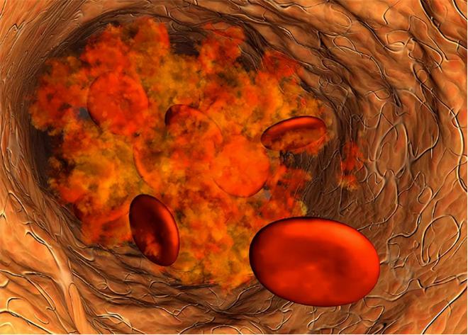 人体硒吃什么食物补（人体补食物吃硒可以吗）-硒宝网