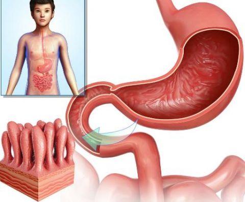 胃癌是不是需要补硒（胃癌补硒有用吗）-硒宝网