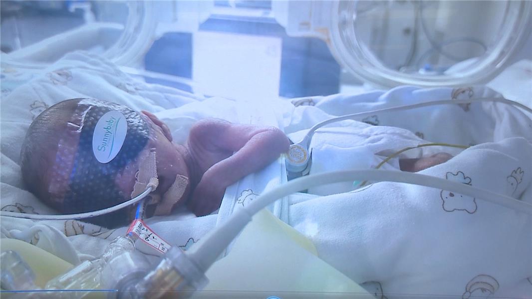 孕妇可以补铁吗（孕妇补铁可以喝牛奶吗）-硒宝网