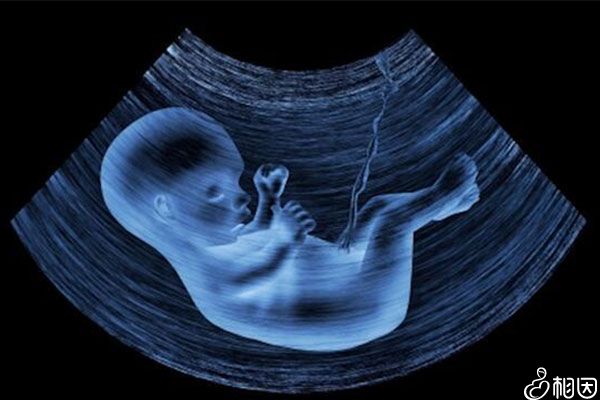 孕妇可以补铁吗（孕妇补铁可以喝牛奶吗）-硒宝网