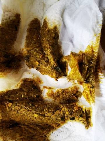 孕晚期补铁大便黑色（怀孕后期补铁大便黑色）-硒宝网