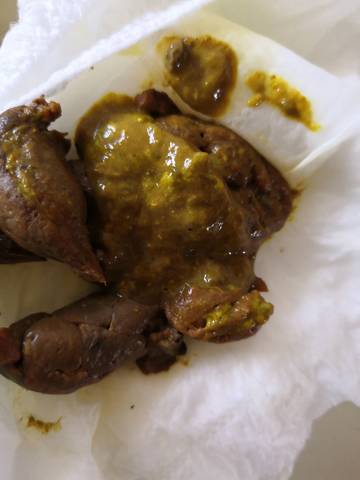 孕晚期补铁大便黑色（怀孕后期补铁大便黑色）-硒宝网