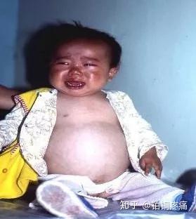 肝病补硒酵母的作用(硒酵母片治疗肝病吗)-硒宝网