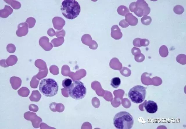 癌症是不是不能补硒（癌症能补是硒元素吗）-硒宝网