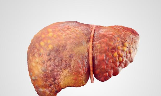 肝癌晚期补硒吃什么（肝癌晚期可以补硒吗）-硒宝网