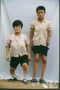 宝宝缺硒怎么补最快（宝宝缺硒会引起哪些疾病）-硒宝网