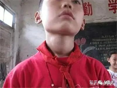 宝宝缺硒怎么补最快（宝宝缺硒会引起哪些疾病）-硒宝网