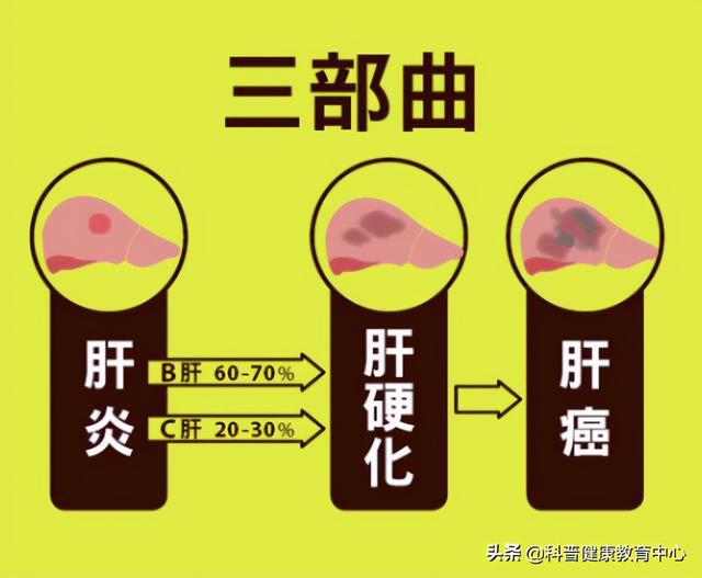 补硒可以治疗肝癌吗(肝癌补硒)-硒宝网