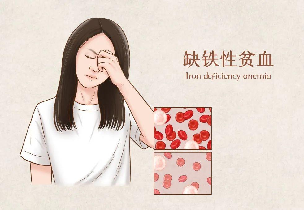 吃什么药补铁（吃补铁的药要吃多久）-硒宝网