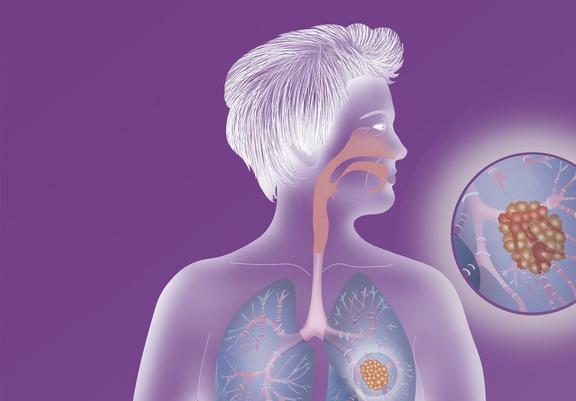 甲亢治疗补硒推荐药（甲亢补硒的药）-硒宝网