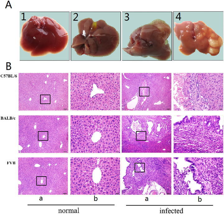 肝硬化患者怎么补硒(肝硬化患者缺硒吗)-硒宝网