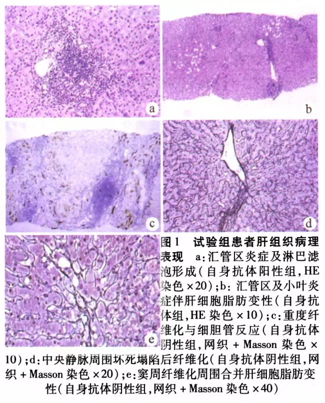 肝硬化患者怎么补硒(肝硬化患者缺硒吗)-硒宝网